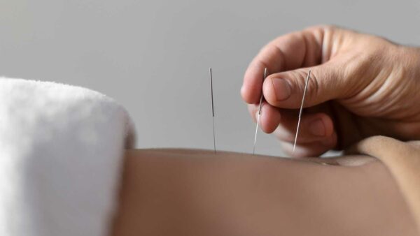 Agopuntura medicina cinese a Lugano dott. Peloni